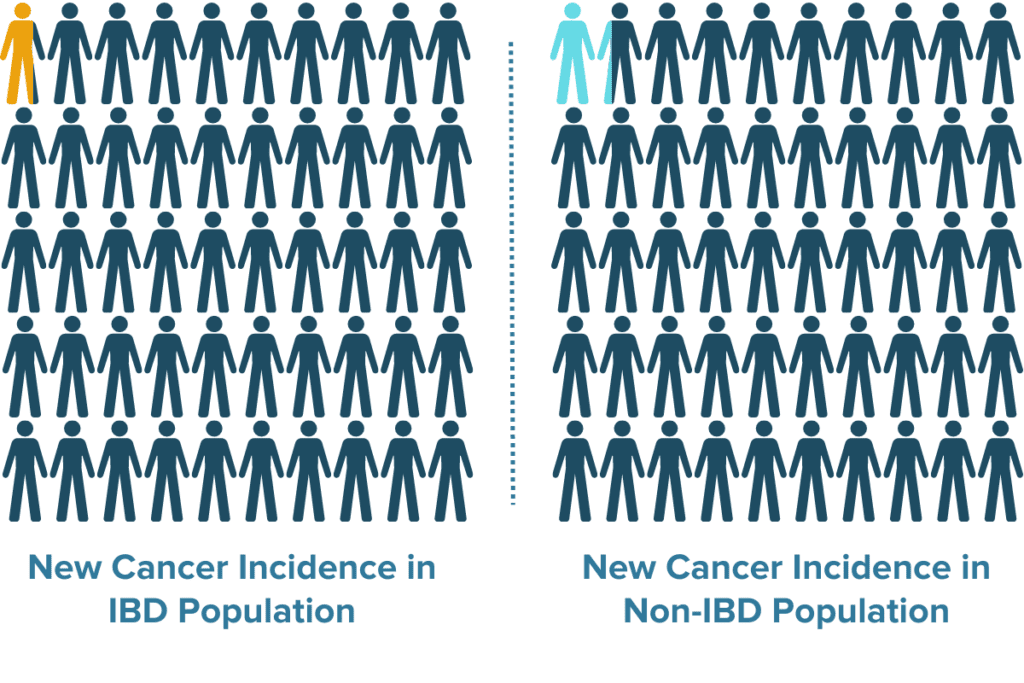 A diagram shows that the relative risk of a new cancer diagnosis is roughly the same in people with and without IBD: about 1 in 50 individuals in either group. 